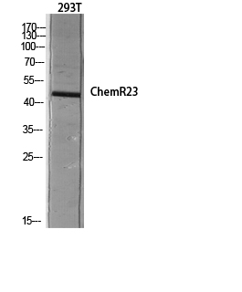 Fig.4. Western blot analysis of 293T lysis using ChemR23 antibody. Antibody was diluted at 1:1000.