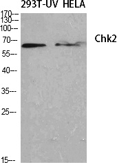 Fig.1. Western Blot analysis of various cells using Chk2 Polyclonal Antibody diluted at 1:500.