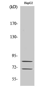 Fig. Western Blot analysis of various cells using Choactase Polyclonal Antibody diluted at 1:1000.