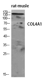 Fig.1. Western Blot analysis of various cells using COL4A1 Polyclonal Antibody diluted at 1:500.