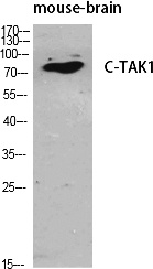 Fig.1. Western Blot analysis of various cells using C-TAK1 Polyclonal Antibody diluted at 1:500.