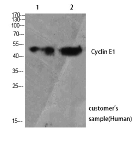 Fig.2. Western Blot analysis of customer's using Cyclin E1 Polyclonal Antibody. Antibody was diluted at 1:1000.