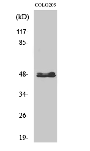 Fig. Western Blot analysis of various cells using CYP11B1/2 Polyclonal Antibody.