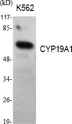 Fig.1. Western Blot analysis of various cells using CYP19A1 Polyclonal Antibody diluted at 1:1000.