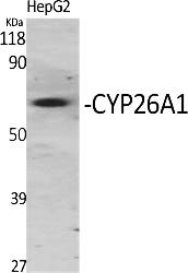 Fig.1. Western Blot analysis of various cells using CYP26A1 Polyclonal Antibody diluted at 1:1000.