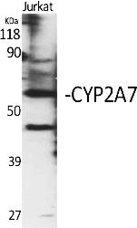Fig.1. Western Blot analysis of various cells using CYP2A7 Polyclonal Antibody diluted at 1:2000.