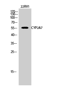 Fig.2. Western Blot analysis of 22RV1 cells using CYP2A7 Polyclonal Antibody diluted at 1:2000.