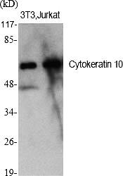 Fig.1. Western Blot analysis of various cells using Cytokeratin 10 Polyclonal Antibody.
