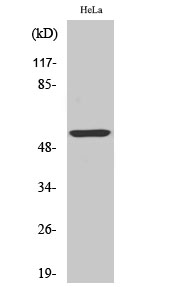 Fig.2. Western Blot analysis of HeLa cells using Cytokeratin 10 Polyclonal Antibody.