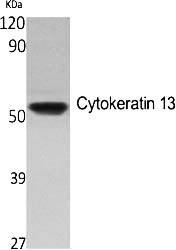 Fig.1. Western Blot analysis of various cells using Cytokeratin 13 Polyclonal Antibody.