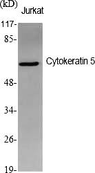 Fig.1. Western Blot analysis of various cells using Cytokeratin 5 Polyclonal Antibody diluted at 1:1000.