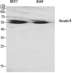 Fig.1. Western Blot analysis of various cells using Cytokeratin 8 Polyclonal Antibody diluted at 1:2000.