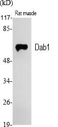 Fig.1. Western Blot analysis of various cells using Dab1 Polyclonal Antibody.