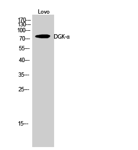 Fig.2. Western Blot analysis of Lovo cells using DGK-α Polyclonal Antibody.
