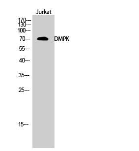 Fig.2. Western Blot analysis of Jurkat cells using DMPK Polyclonal Antibody.