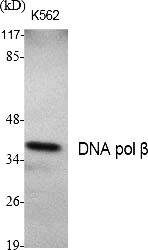 Fig.1. Western Blot analysis of various cells using DNA pol β Polyclonal Antibody.