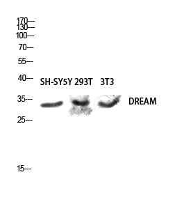 Fig.2. Western blot analysis of SH-SY5Y 293T 3T3 lysis using DREAM antibody. Antibody was diluted at 1:500.
