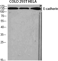 Fig.1. Western Blot analysis of various cells using E-cadherin Polyclonal Antibody diluted at 1:1000.