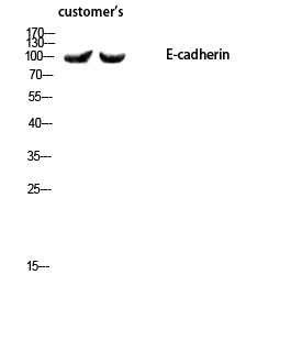 Fig.3. Western blot analysis of customer's using E-cadherin Polyclonal Antibody diluted at 1:1000.