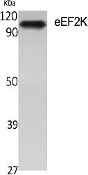 Fig.1. Western Blot analysis of various cells using eEF2K Polyclonal Antibody diluted at 1:500.