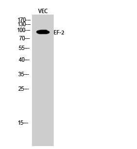 Fig.2. Western Blot analysis of VEC cells using EF-2 Polyclonal Antibody diluted at 1:2000.