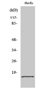 Fig. Western Blot analysis of various cells using eIF5A2 Polyclonal Antibody diluted at 1:1000.