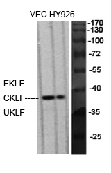 Fig.1. Western Blot analysis of various cells using EKLF/CKLF/UKLF Polyclonal Antibody diluted at 1:500.