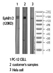 Fig.1. Western Blot analysis of various cells using EphB1/2 Polyclonal Antibody diluted at 1:500.