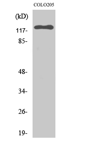 Fig. Western Blot analysis of various cells using EphB6 Polyclonal Antibody.