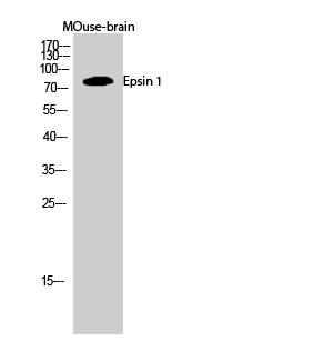 Fig.2. Western Blot analysis of MOuse-brain cells using Epsin 1 Polyclonal Antibody diluted at 1:1000.