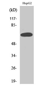 Fig. Western Blot analysis of various cells using ERα Polyclonal Antibody diluted at 1:500.