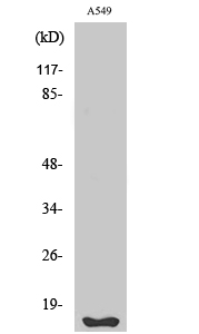 Fig. Western Blot analysis of various cells using Fhit Polyclonal Antibody.