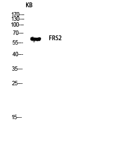 Fig.3. Western blot analysis of KB lysis using FRS2 antibody. Antibody was diluted at 1:1000.