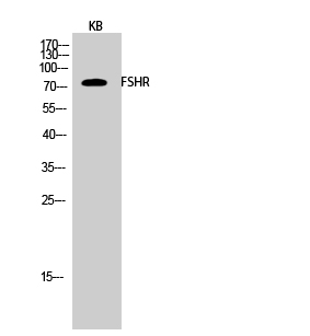 Fig.2. Western Blot analysis of KB cells using FSHR Polyclonal Antibody diluted at 1:1000.