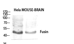 Fig.1. Western Blot analysis of various cells using Fusin Polyclonal Antibody diluted at 1:1000.