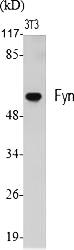 Fig.1. Western Blot analysis of various cells using Fyn Polyclonal Antibody diluted at 1:2000.