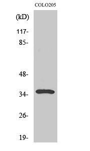 Fig. Western Blot analysis of various cells using Galectin-4 Polyclonal Antibody.
