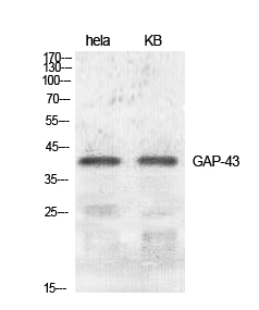 Fig. 1. Western Blot analysis of various cells using GAP-43 Polyclonal Antibody diluted at 1:500.