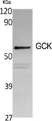 Fig.1. Western Blot analysis of various cells using GCK Polyclonal Antibody diluted at 1:1000.