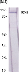 Fig.1. Western Blot analysis of various cells using GCN5 Polyclonal Antibody diluted at 1:1000.