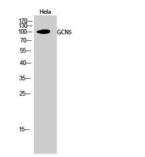 Fig.2. Western Blot analysis of hela cells using GCN5 Polyclonal Antibody diluted at 1:1000.