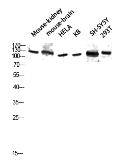 Fig.3. Western blot analysis of Mouse-kidney, Mouse-brain, hela, KB, SH-SY5Y, 293T lysate using GCP5 antibody. Antibody was diluted at 1:2000.