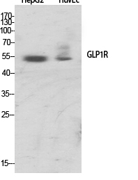 Fig.1. Western Blot analysis of various cells using GLP-1R Polyclonal Antibody.