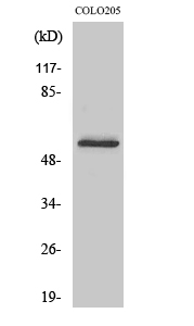 Fig.2. Western Blot analysis of COLO205 cells using Glucagon Receptor Polyclonal Antibody.