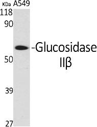 Fig.1. Western Blot analysis of various cells using Glucosidase IIβ Polyclonal Antibody.