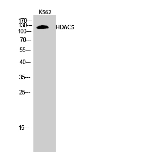 Fig.2. Western Blot analysis of K562 cells using HDAC5 Polyclonal Antibody.