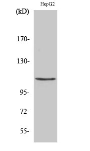 Fig.2. Western Blot analysis of HepG2 cells using Histone deacetylase 9 Polyclonal Antibody diluted at 1:1000.