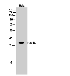 Fig.2. Western Blot analysis of hela cells using Hox-B9 Polyclonal Antibody diluted at 1:1000.