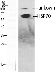 Fig.1. Western Blot analysis of various cells using HSP70 Polyclonal Antibody diluted at 1:1000.