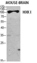 Fig.1. Western Blot analysis of various cells using HXK I Polyclonal Antibody diluted at 1:1000.